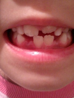 20090521tooth.jpg