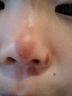 20090526nose.jpg