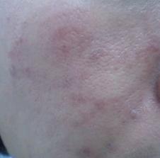 20090911nikibi2.jpg