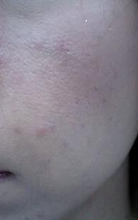 20090911nikibi3.jpg